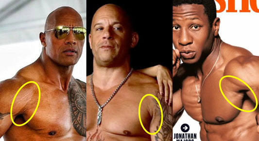 stretch marks on celebrities like Dwayne The Rock Johnson