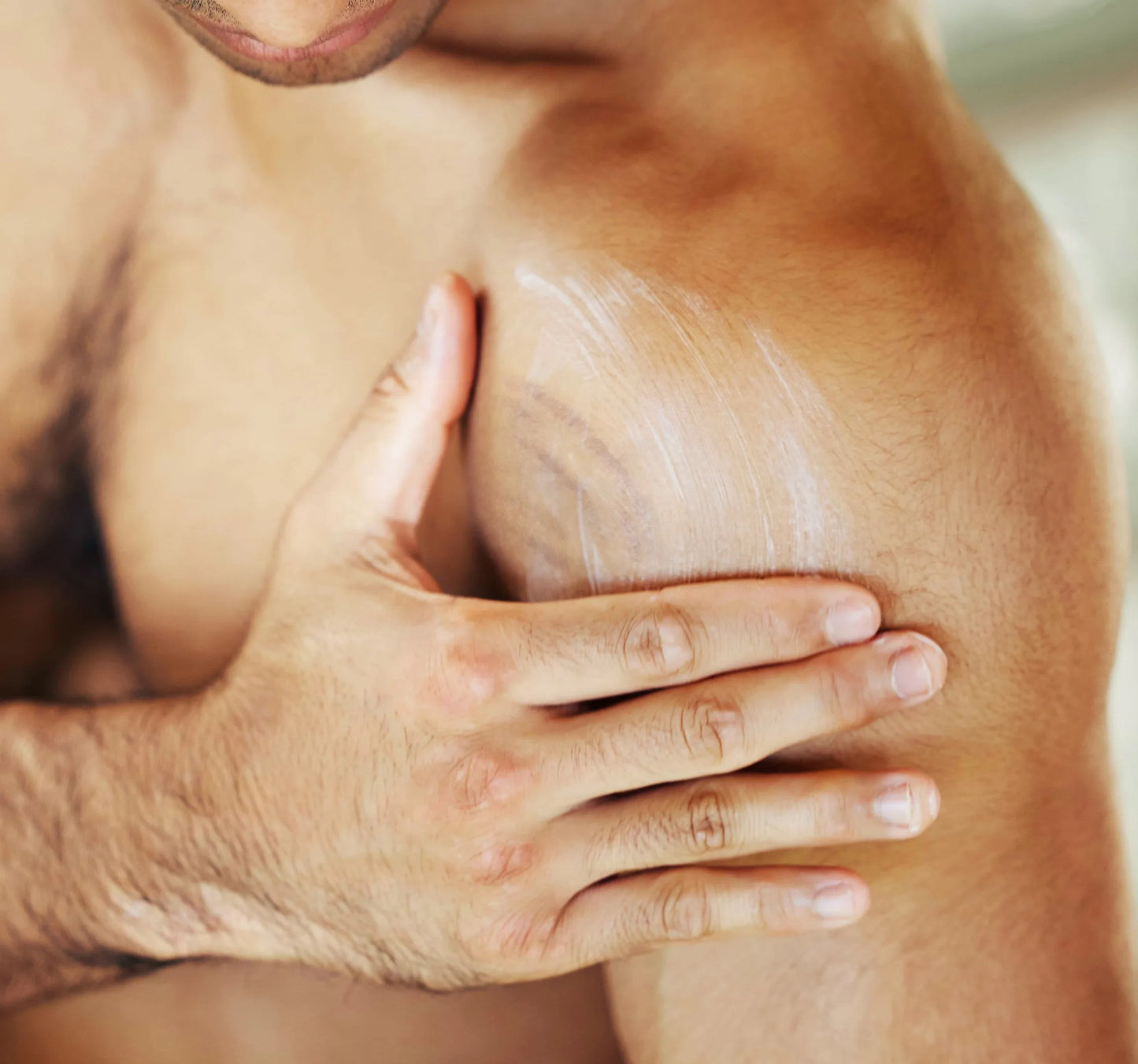 Man applying stretch mark cream to stretch marks and scars