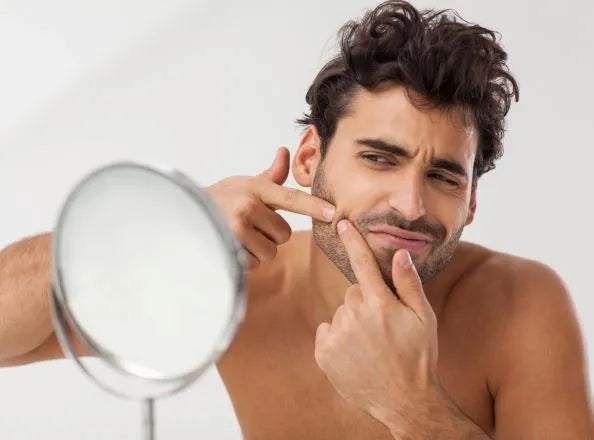 man will small pimples and acne in beard