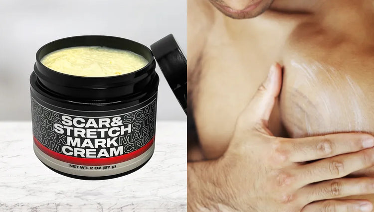 scar and stretch mark cream for men. cream reduces appearance of stretch marks on skin