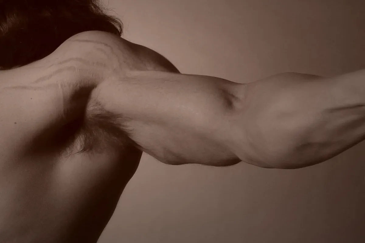 man with stretch marks on shoulder area, arm outstretched, striae albicans